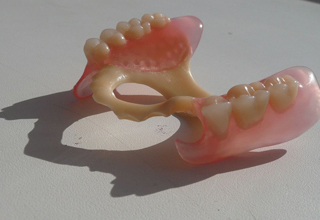 Фото 3. Протезирование зубов