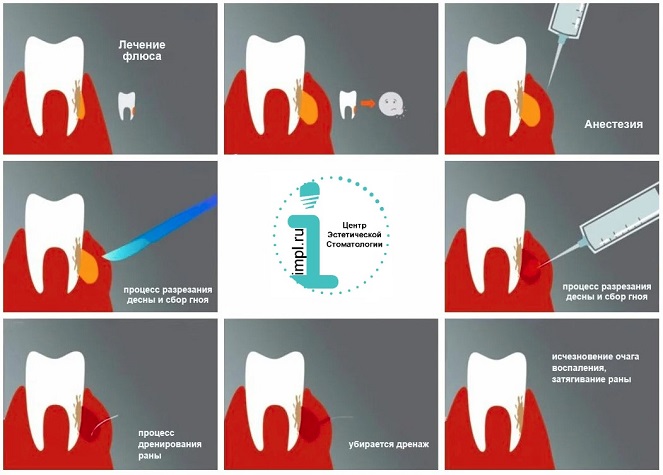 Особенности зубной боли при разных заболеваниях